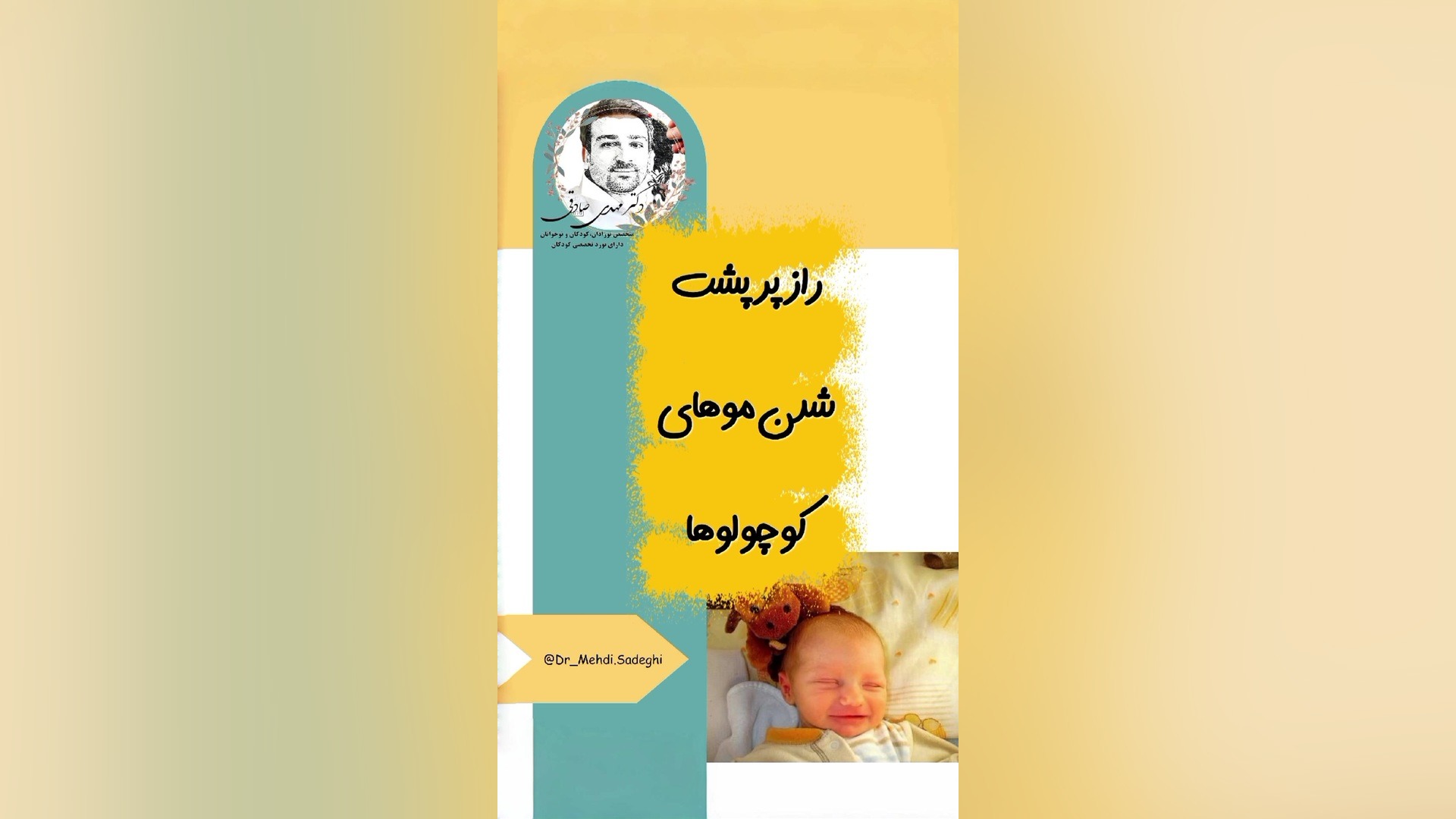 راز پر پشت شدن موی کوچولوها دکتر مهدی صادقی