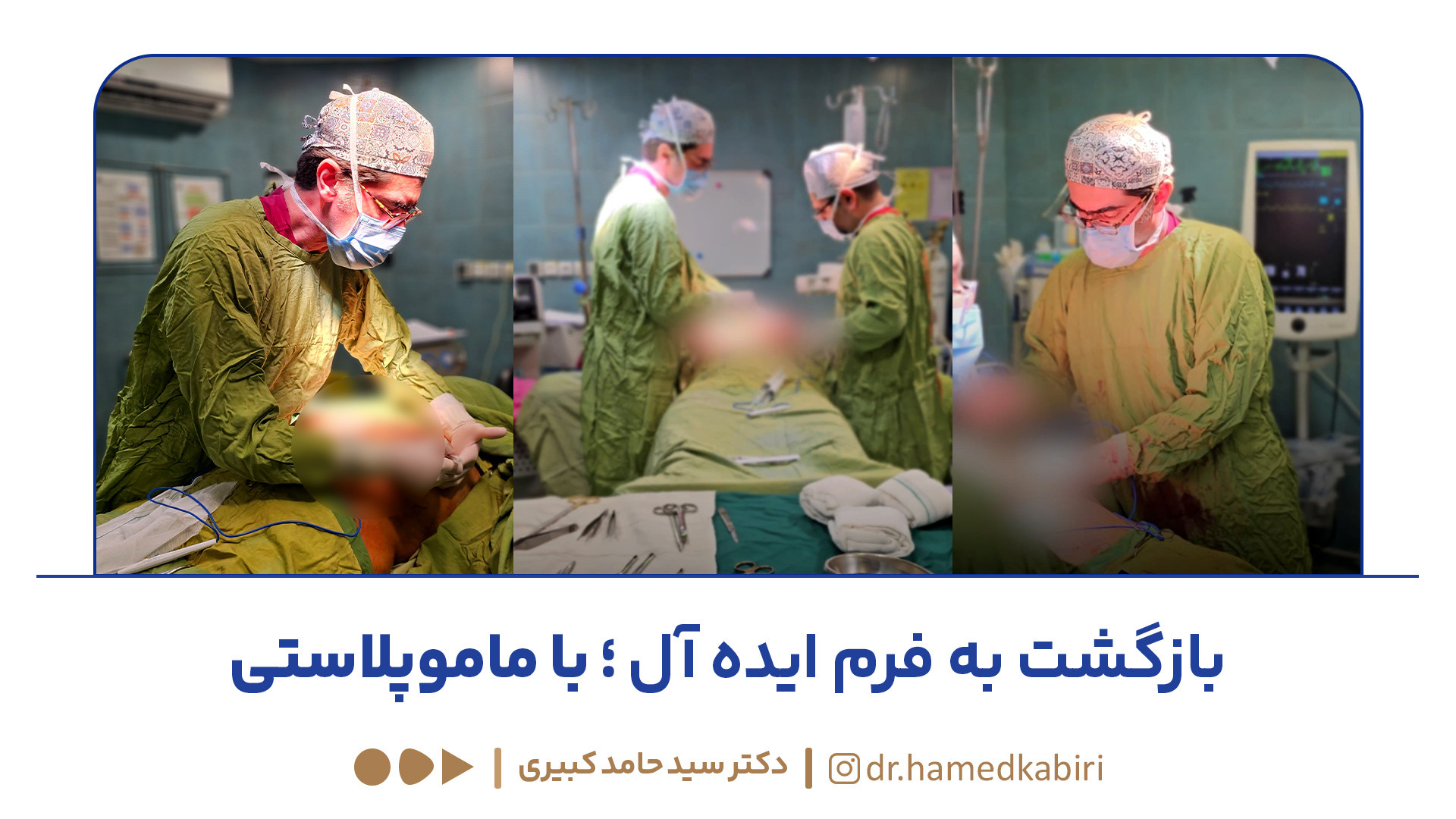جراحی ماموپلاستی | دکتر سید حامد کبیری برداشتن خال گوشتی