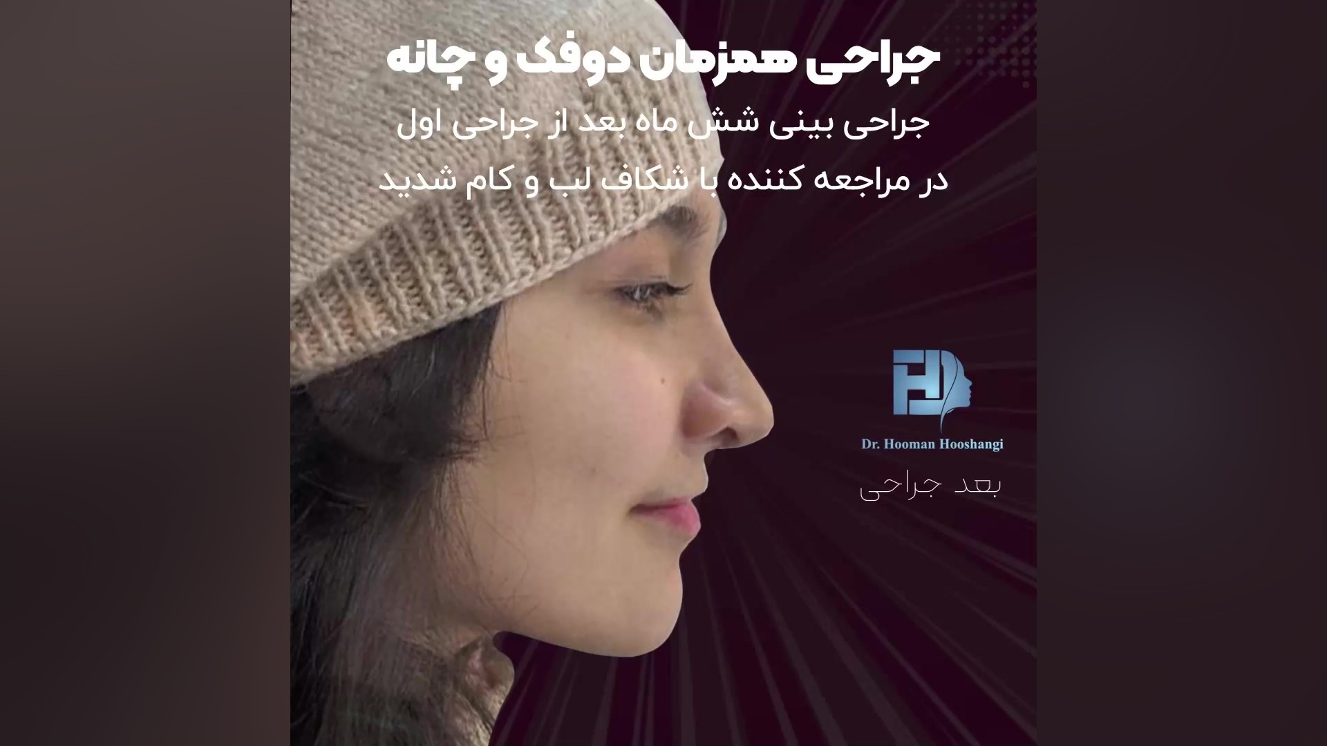 جراحی فک و صورت کابرگولین