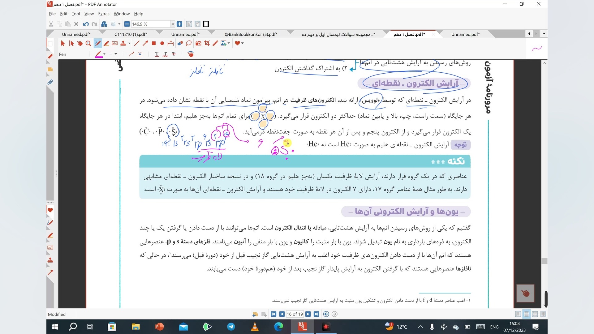 شیمی دهم آرایش الکترونی - قسمت ۴ جراحی فک