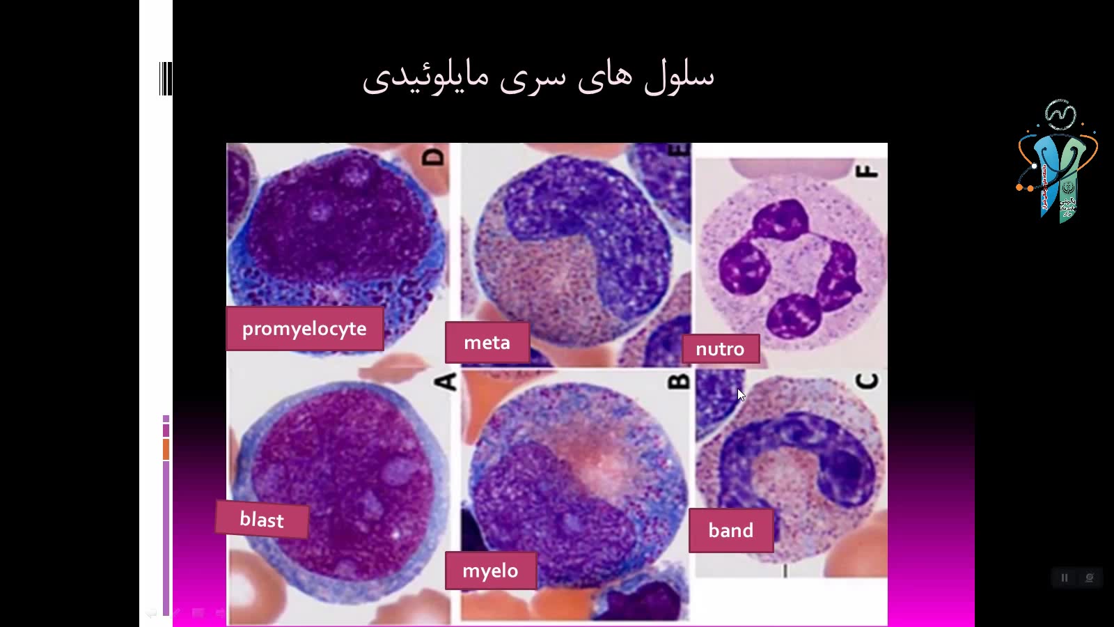 تفسیر آزمایش CBC برای دانشجویان پزشکی عمومی توسط دکتر حبیب اله گل افشان بخش دوم اکستنشن تاج دندان