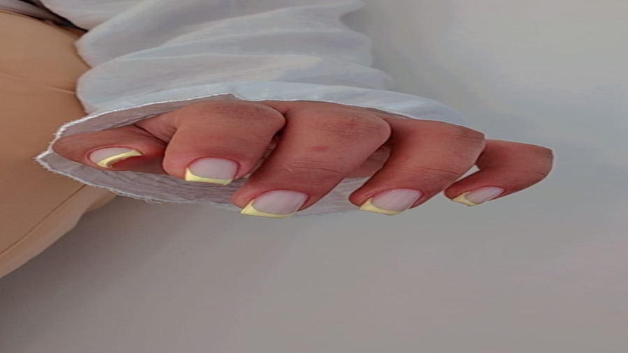 کاشت ناخن  هشتگرد(شهرجدید)(nailartist_pariiya)