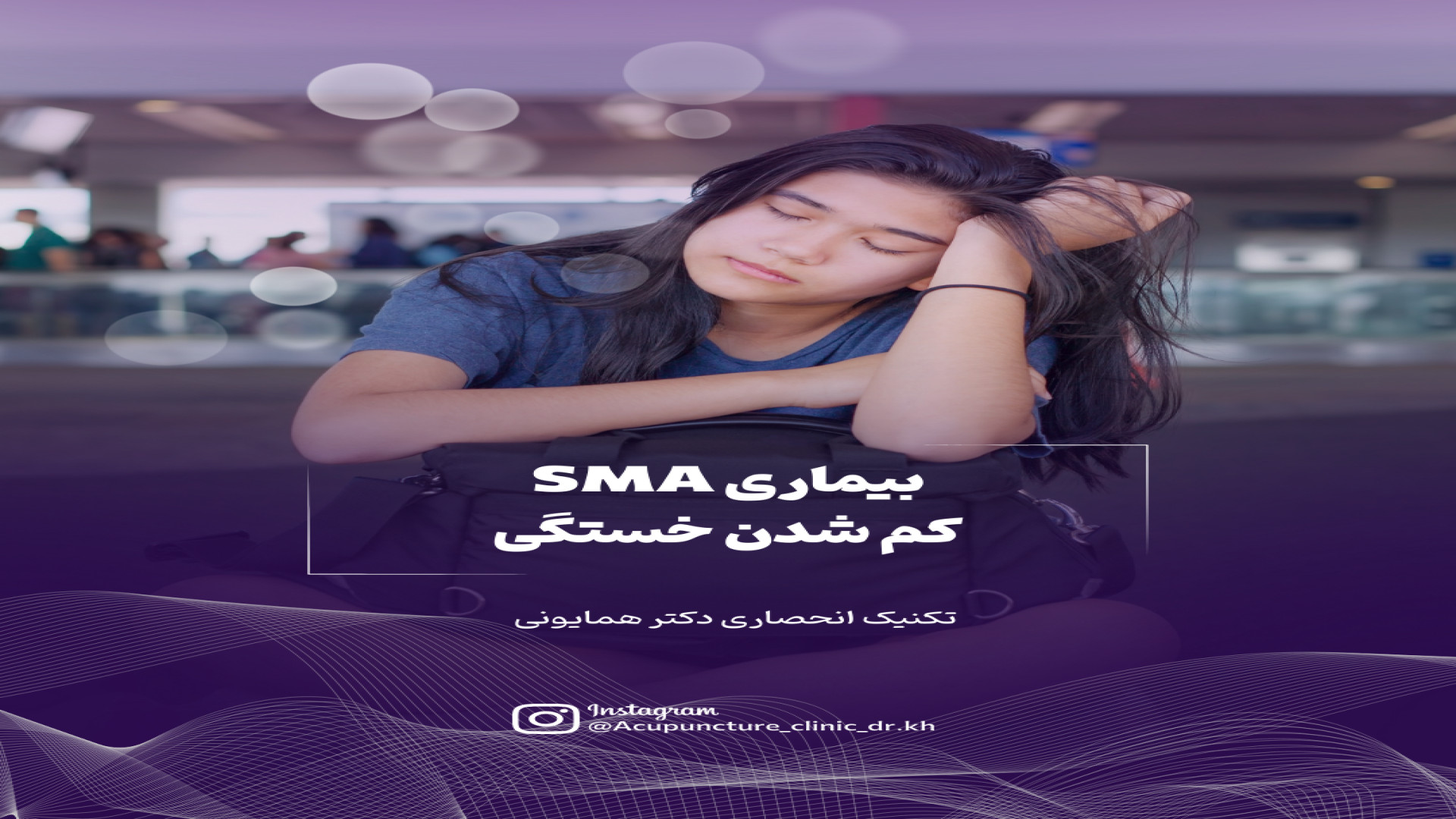 بیماری SMA اختلالات عصبی–عضلانی تزریق ژل
