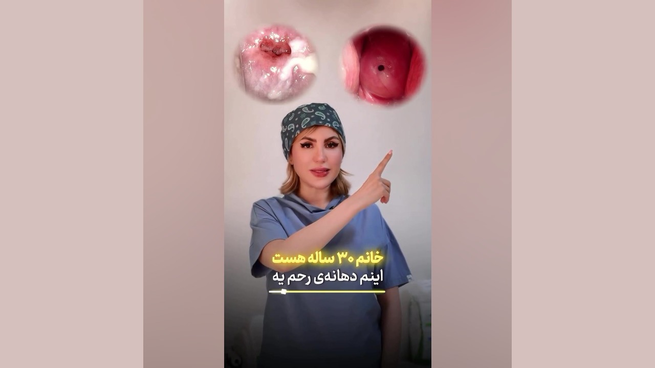 عفونت دهانه رحم دکتر زهره امیری