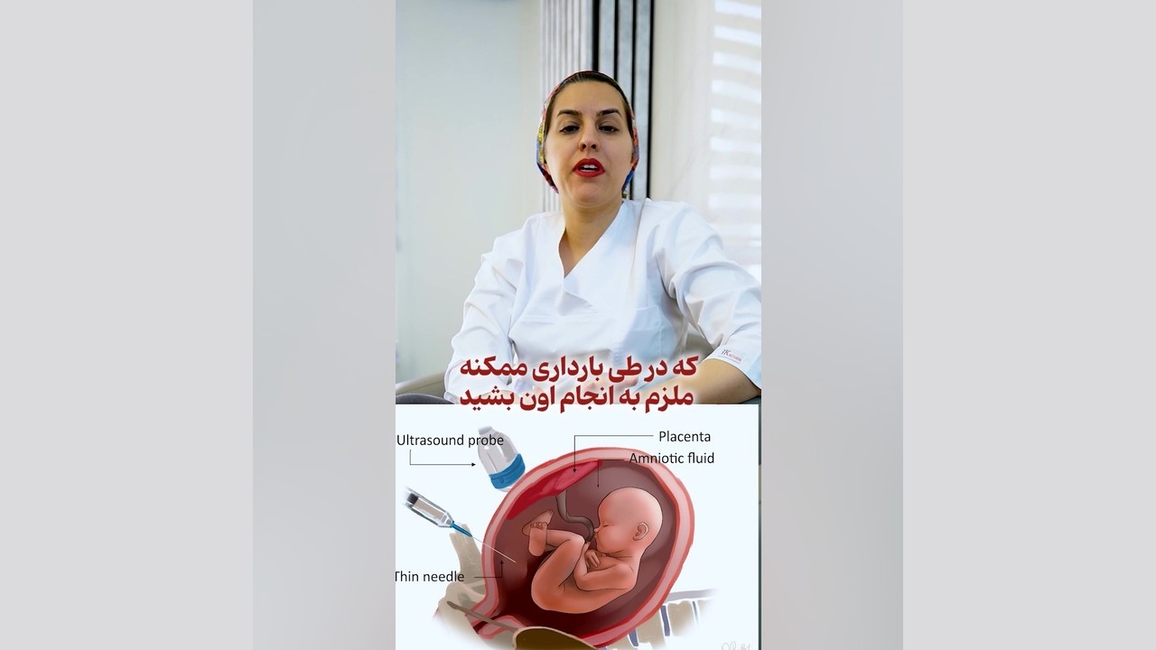 آمنیوسنتز کاشت ریش