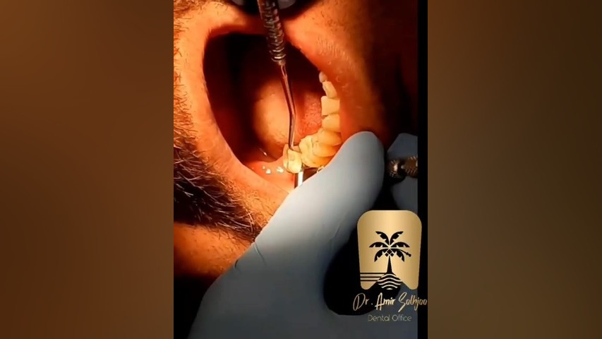 دندانپزشکی فعال در تعطیلات رسمی دندانپزشکی دکتر امیر صلح جو