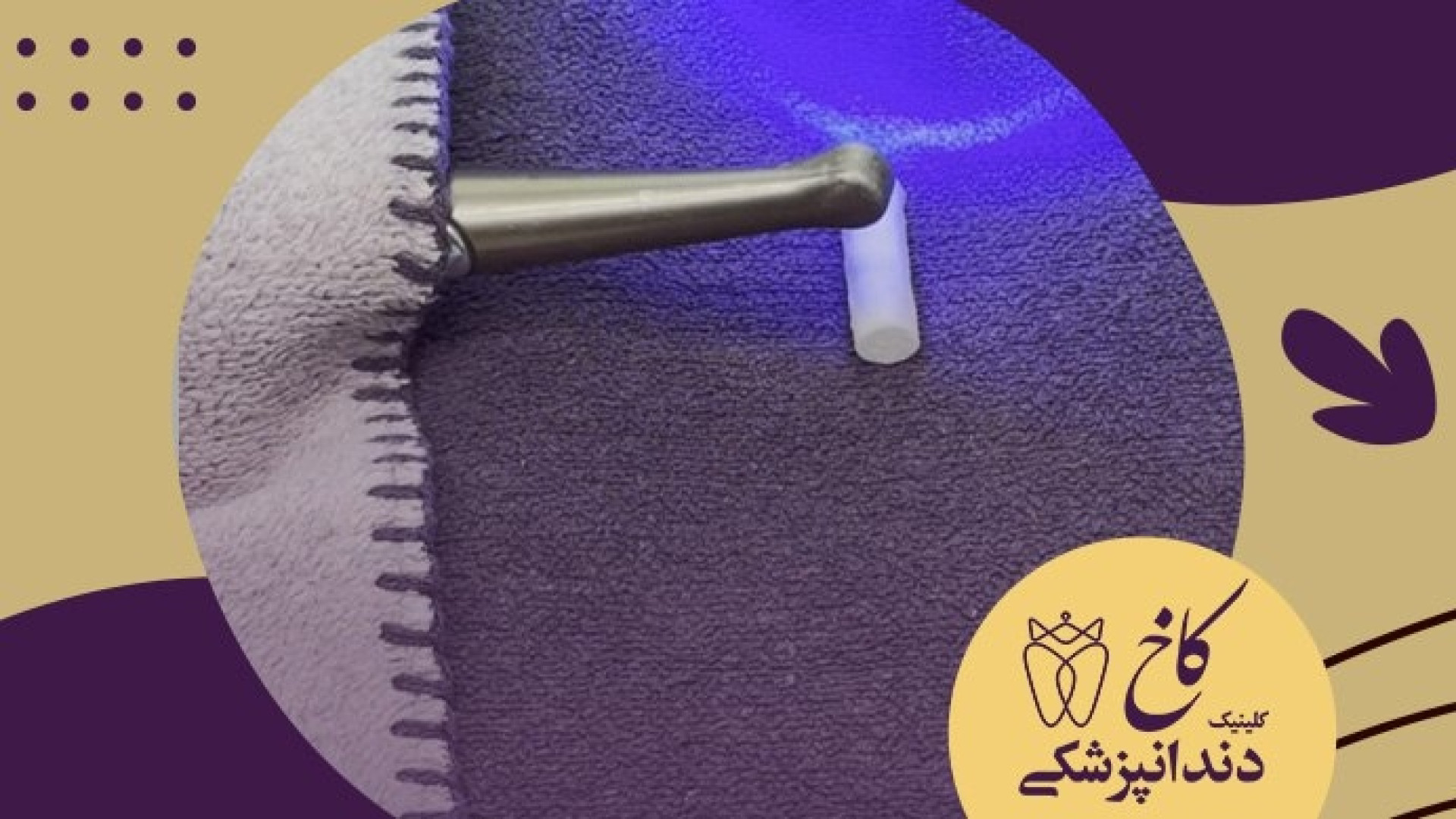 کابوس شبانه لایت کیور؟! کلینیک دندانپزشکی کاخ
