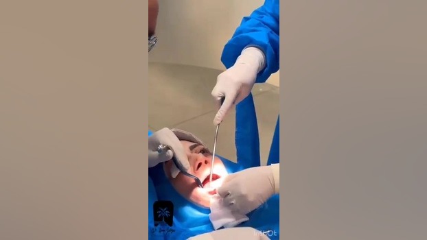 ایمپلنت اقساطی در مرزداران در کلینیک لاکچری دندانپزشکی دکتر امیر صلح جو