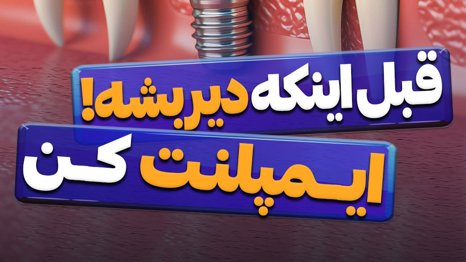 قبل اینکه دیر بشه! ایمپلنت کن هالوسیناتوری بویایی