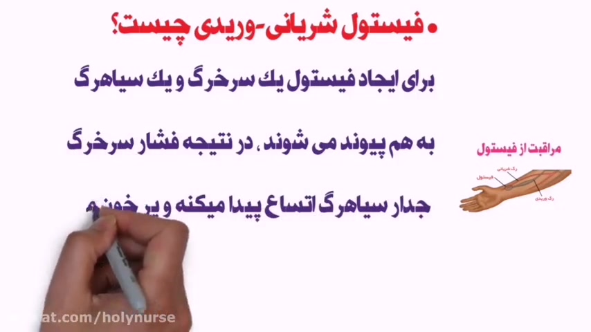 نحوه مراقبت از کاتتر در بیماران دیالیز لولوی بیابون