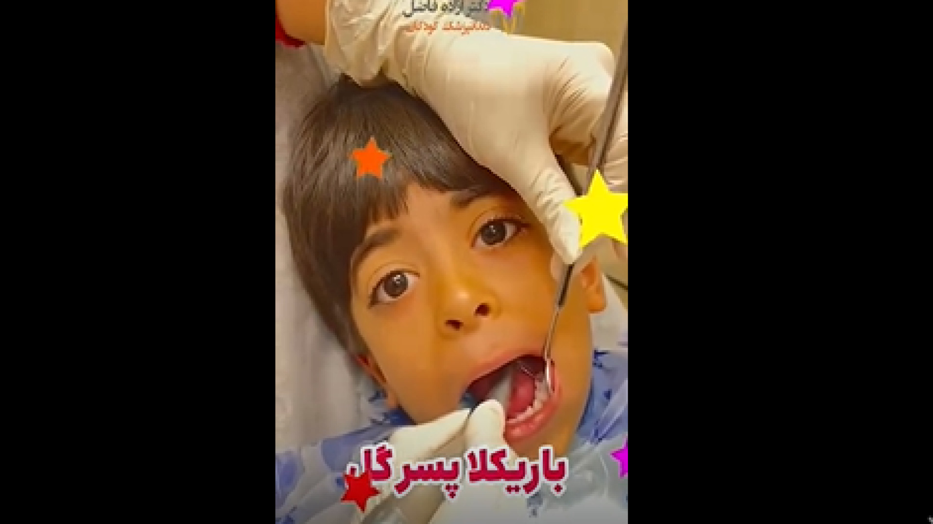 ترمیم کامپوزیت دندان کودکان دکتر آزاده فاضل _ دندان پزشک کودکان