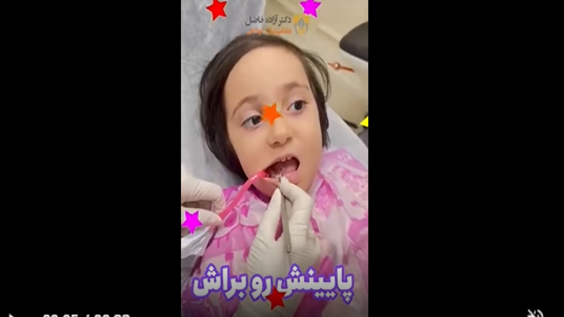 عصب کشی دندان کودکان دکتر آزاده فاضل _ دندان پزشک کودکان