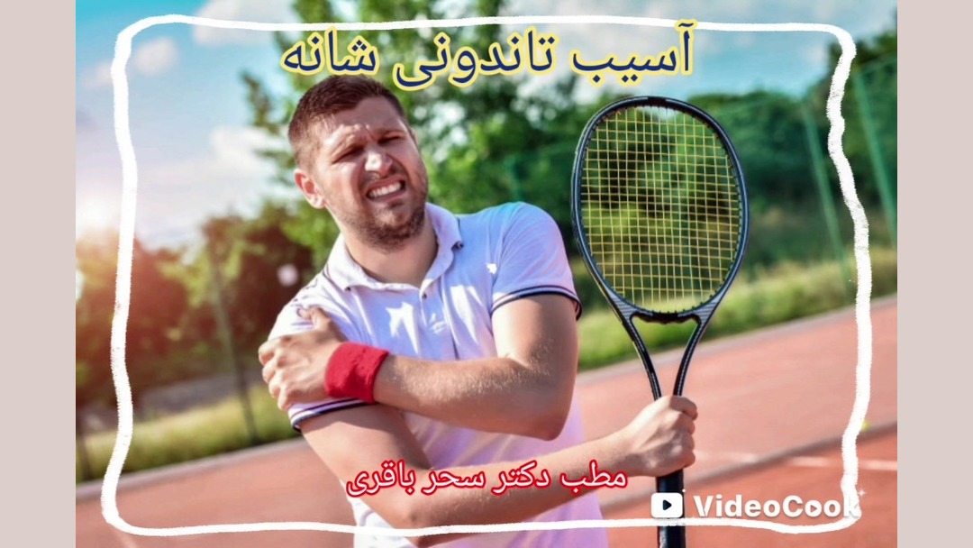 پارگی تاندون شانه دکتر سحر باقری ـ متخصص پزشکی ورزشی