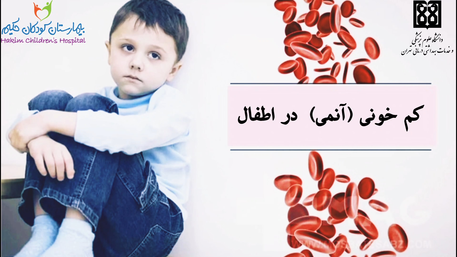 نکاتی مهم درباره کم خونی (آنمی) در کودکان کلینیک دندانپزشکی