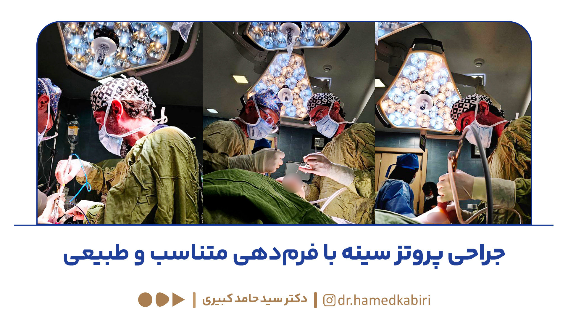 جراحی پروتز سینه با فرم‌دهی متناسب و طبیعی | دکتر سید حامد کبیری کولفی‌تیل