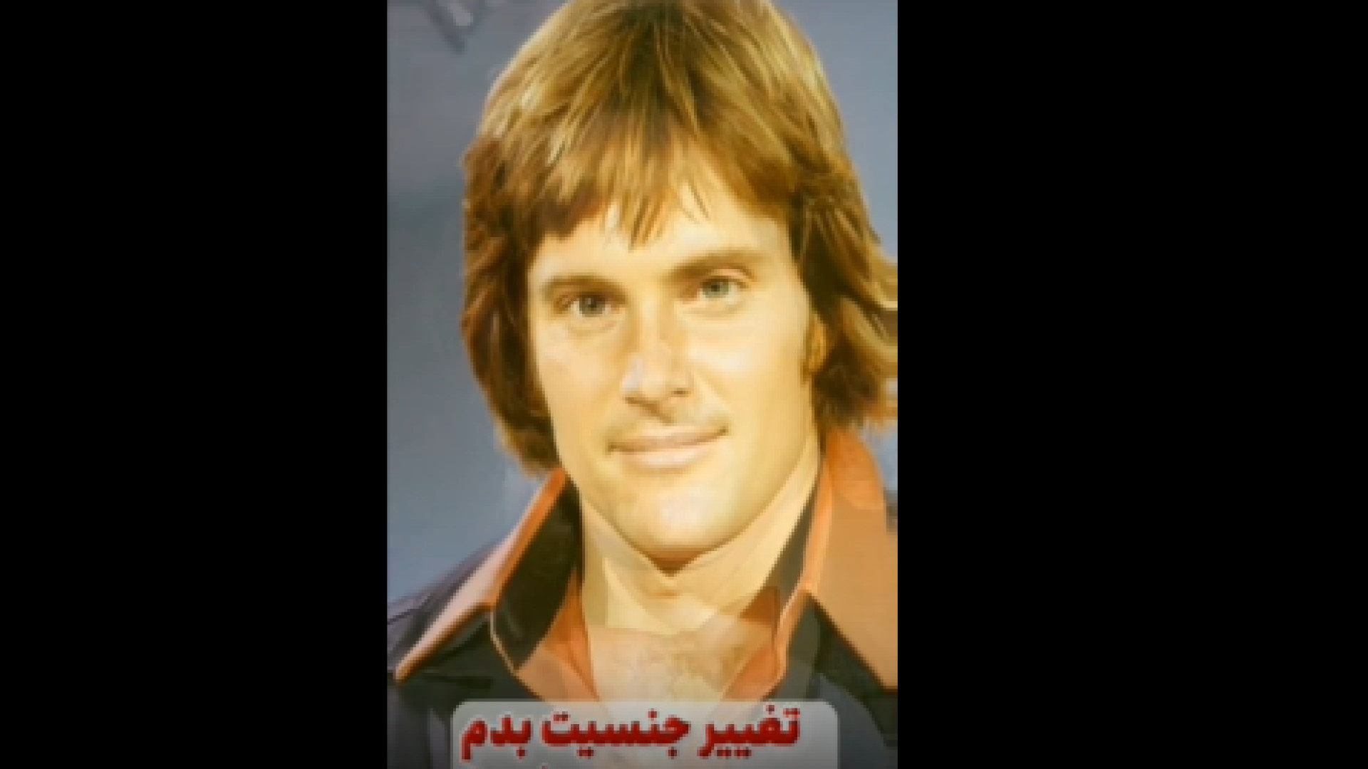 باردار شدن بعد از تغییر جنسیت دکتر محمدرضا آخوندی نسب-فوق تخصص جراحی پلاستیک