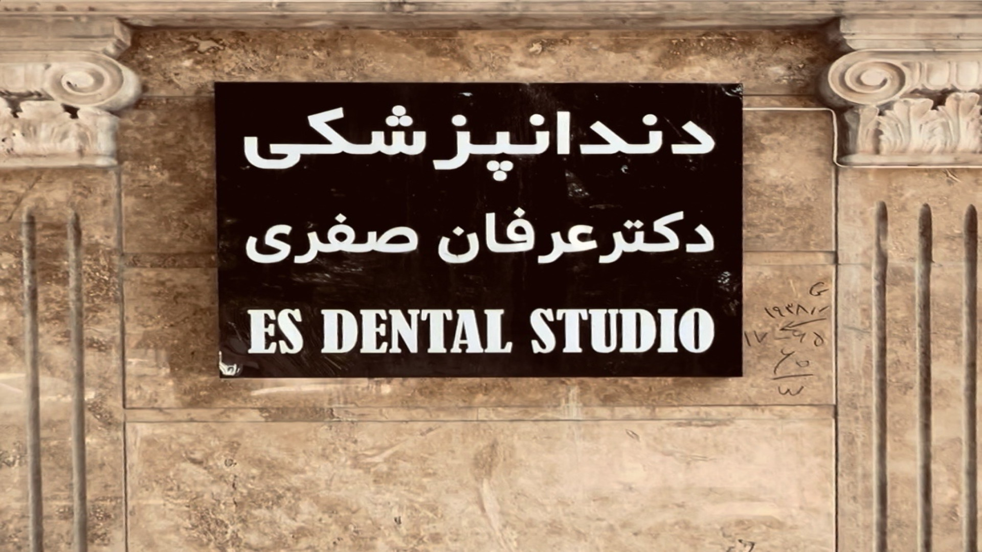ایمپلنت دیجیتال یک روزه شیراز | دکتر عرفان صفری | لکوپنی شدید