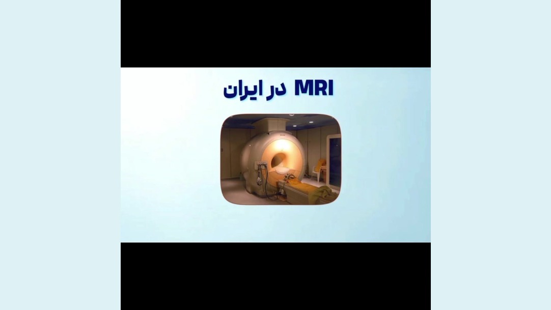 ایرانیز، ایران پیشرو در استفاده از روش پیشرفته در زمینه تصویربرداری پزشکی(MRI) پسر آبجی