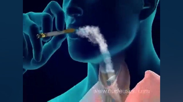 انیمیشن سه بعدی تاثیر سیگار به روی ریه شش ها ترمیم ونیر