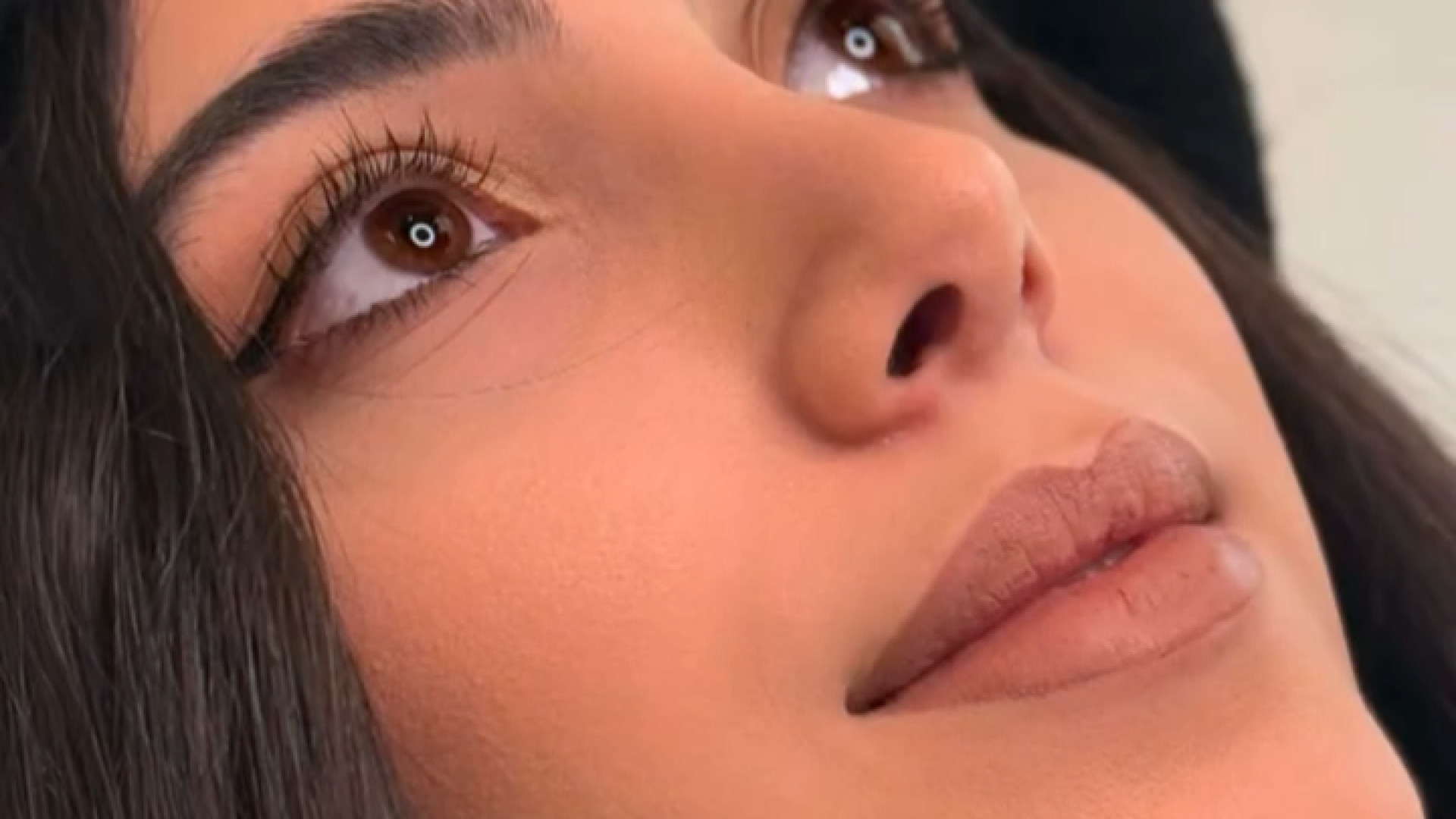 4 ماه بعد از عمل جراحی زیبایی بینی دکتر حمیدرضا مفرد