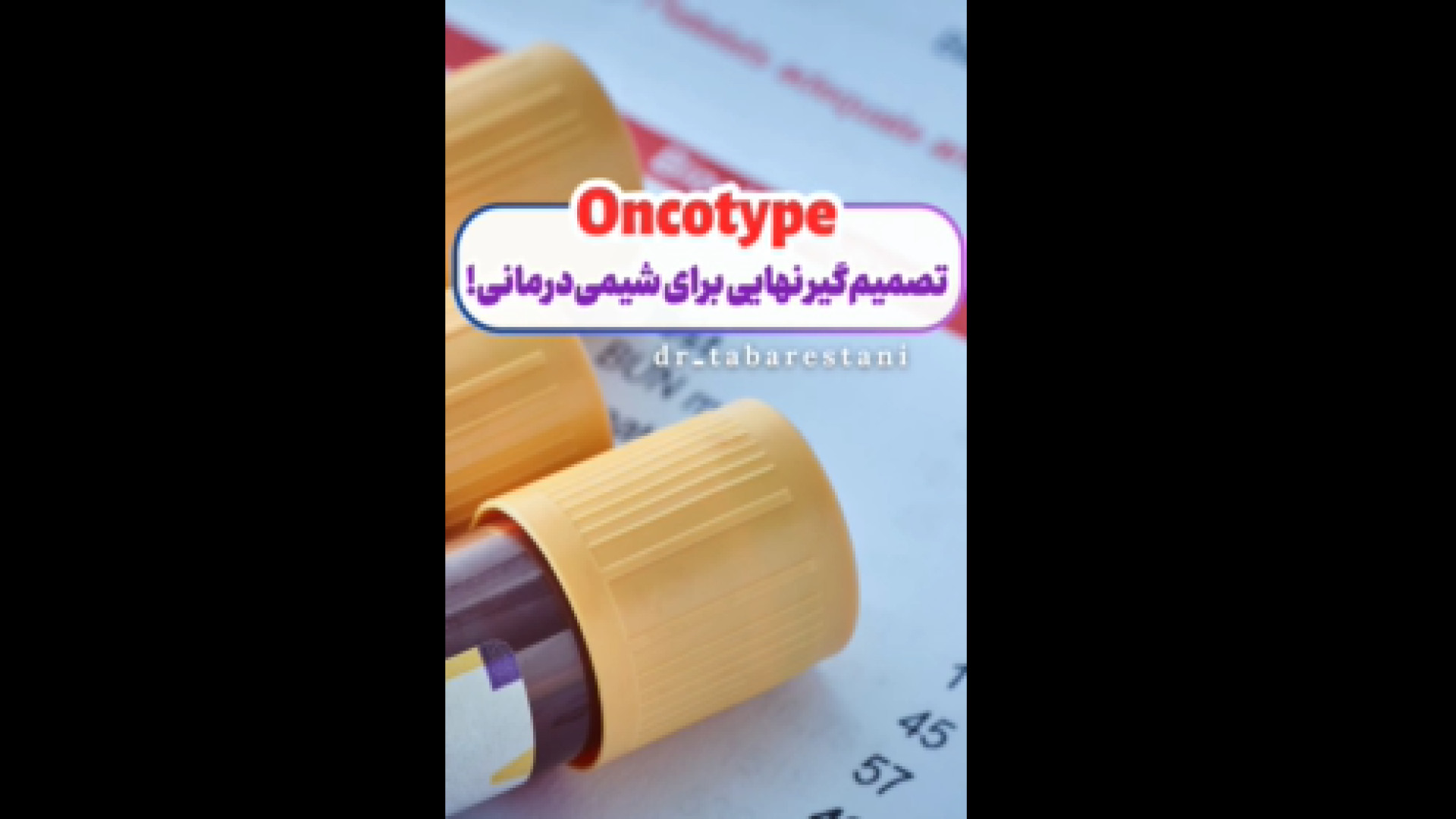 تصمیم گیر نهایی برای شیمی درمانی برداشتن خال گوشتی
