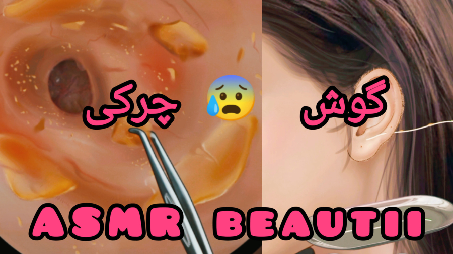 گوش  التهابی