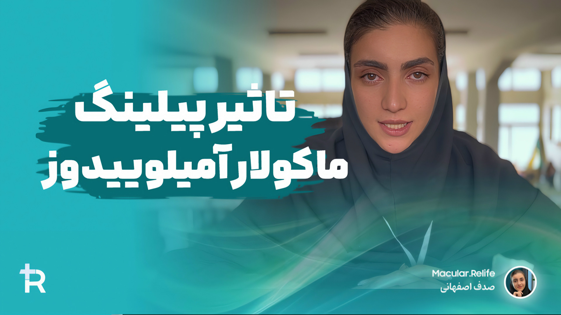 تاثیر پیلینگ بر بیماری ماکولار امیلوییدوز | صدف اصفهانی گیمر