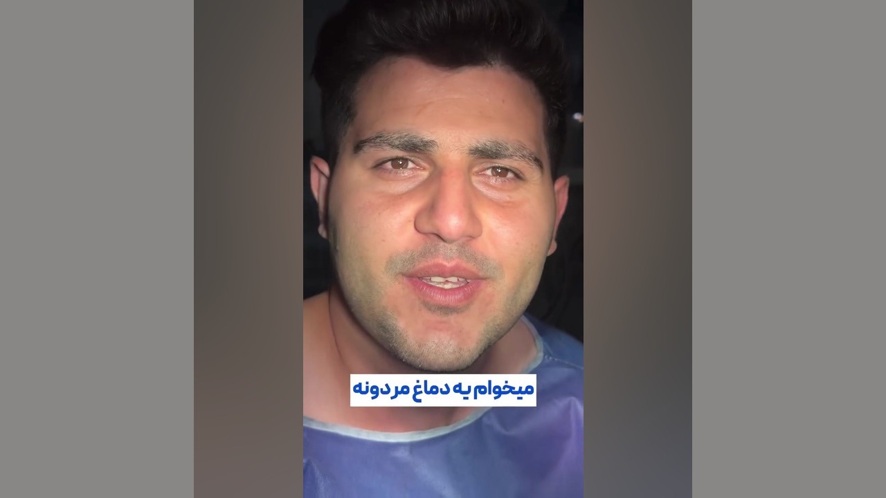عمل بینی مردانه در تهران دکتر علی شفیعی رونیزی | بهترین جراح بینی تهران
