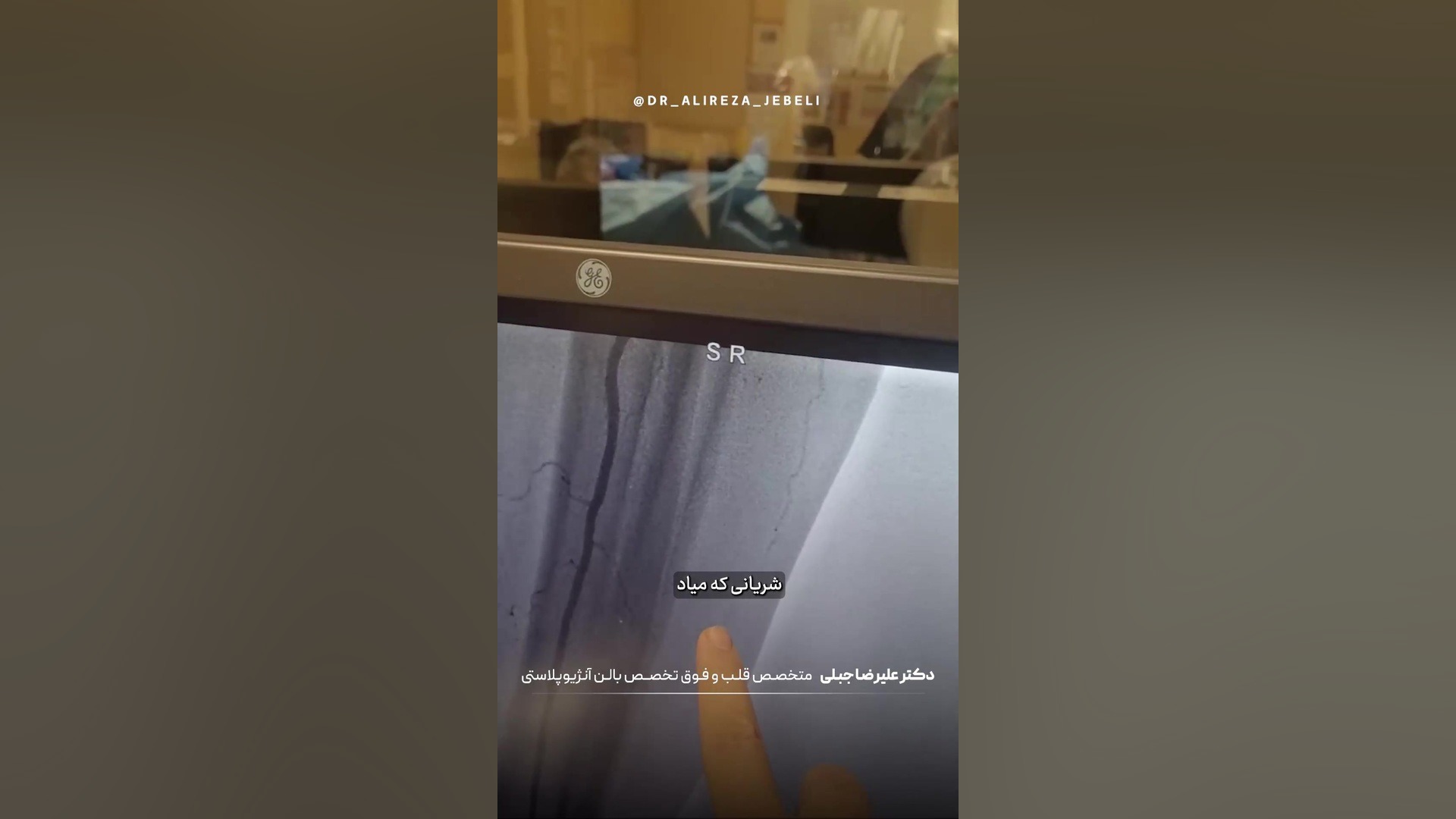 آنژیوگرافی عروق پا کلینیک دندانپزشکی