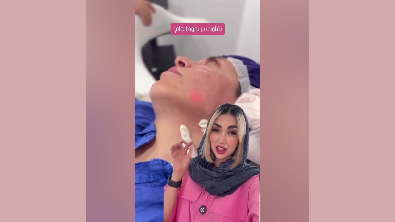 اندولیفت؛ انقلابی در سفت کردن پوست با لیزر کم تهاجم! تزریق ژل