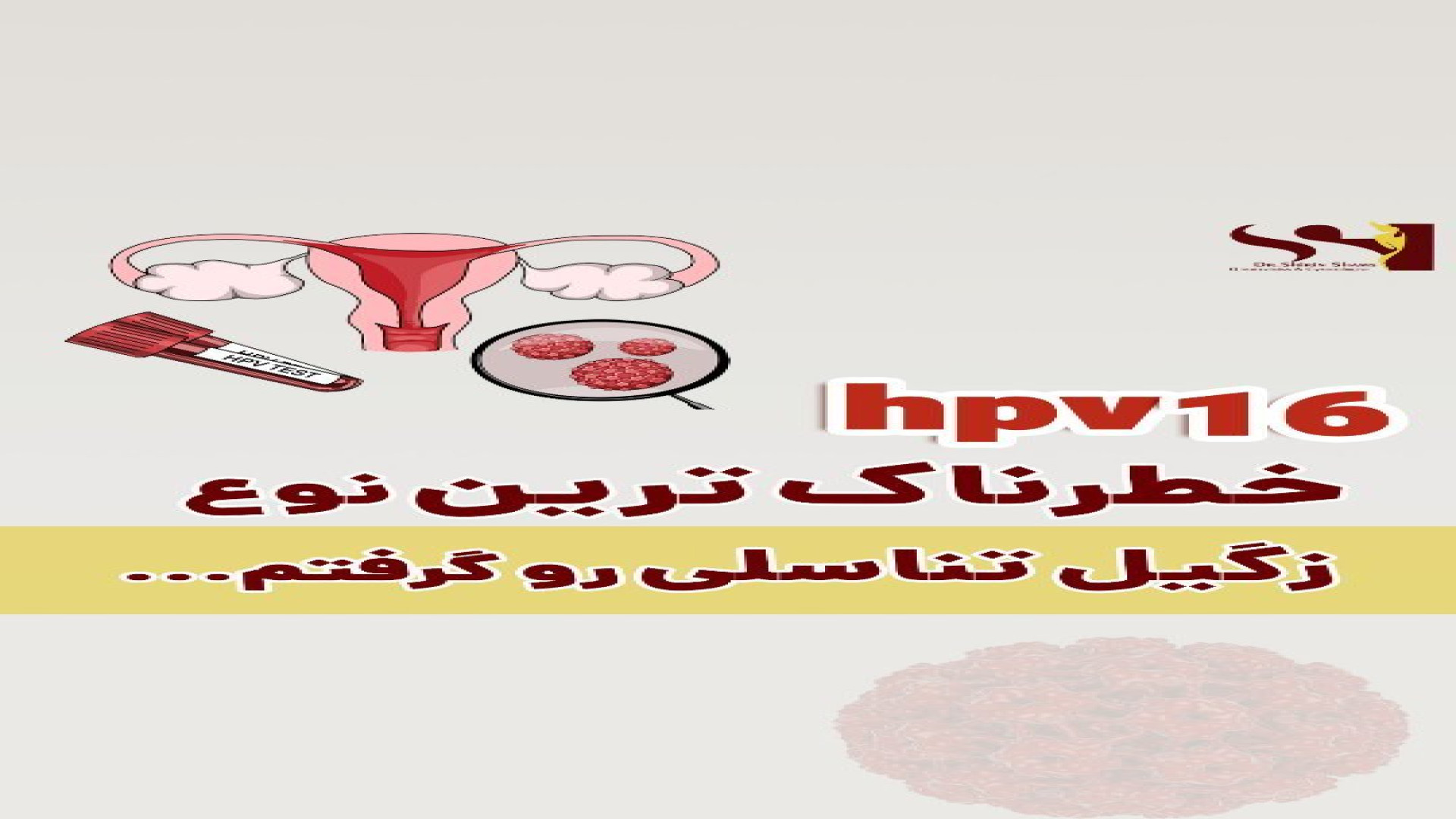 خطرناک ترین نوع زگیل تناسلی دکتر شیرین شمس جراح و متخصص زنان و زایمان