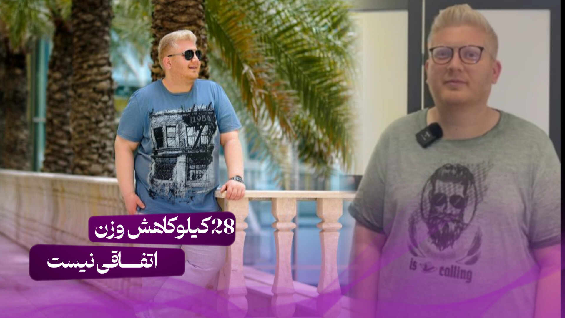 ۲۸ کیلو‌ کاهش وزن در 2 دوره با ایمپلنت های لاغری مدانچ دندانپزشکی کودکان
