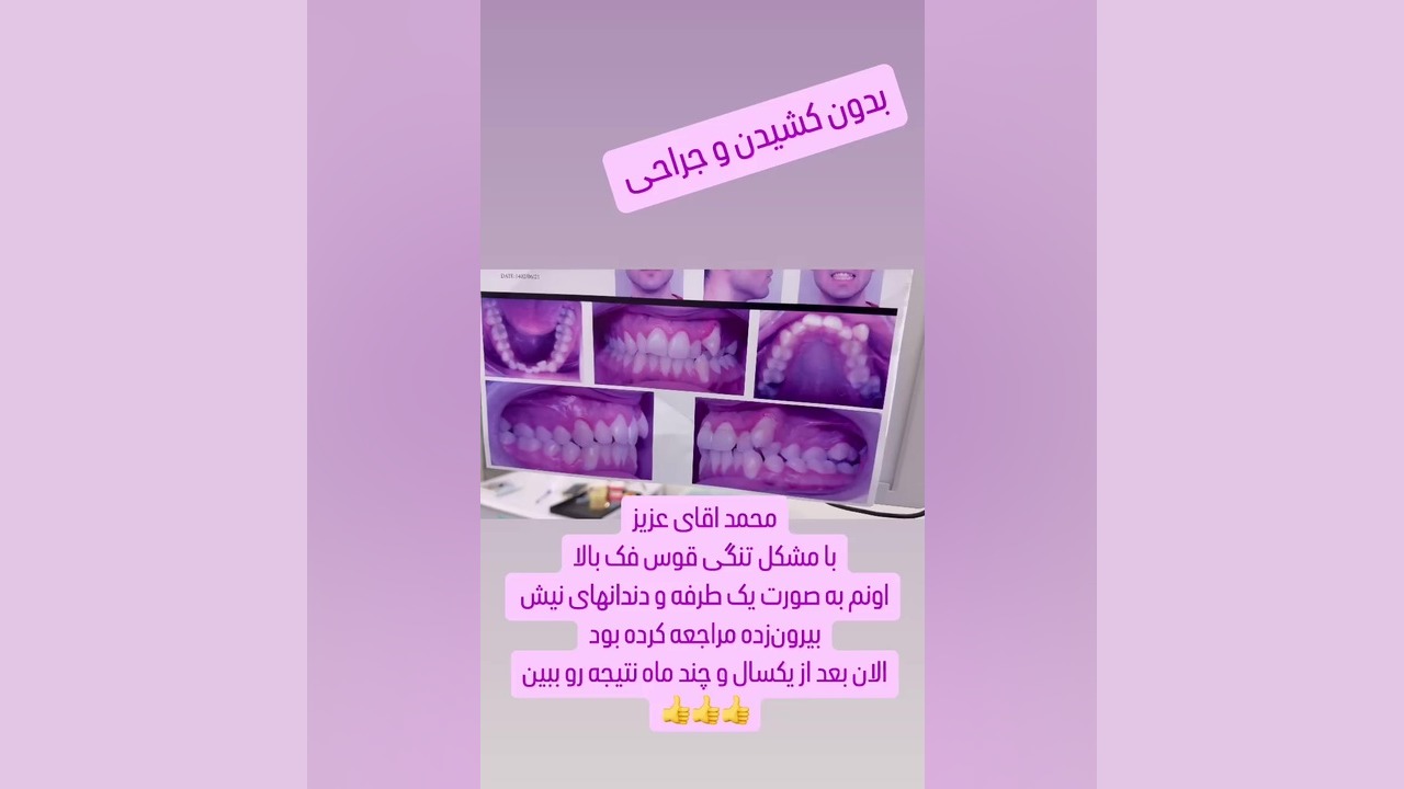 ارتودنسی بدون کشیدن دكتر مهدي فهيمي هنزائي