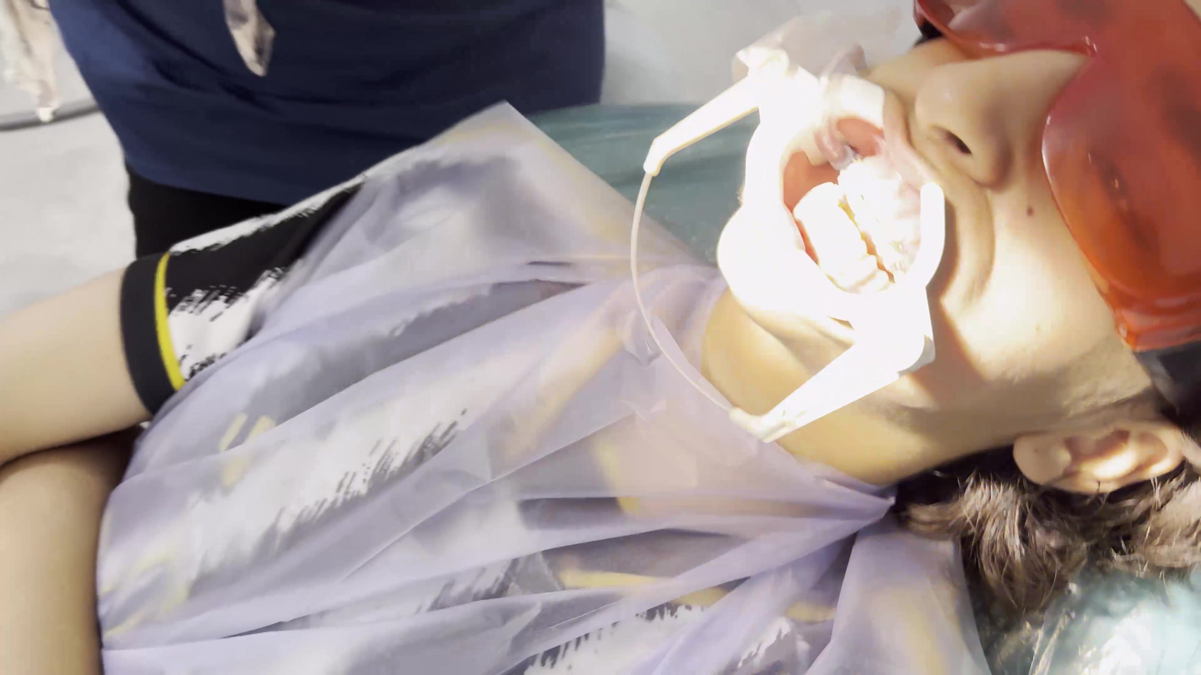 اولین جلسه ارتودنسی دكتر مهدي فهيمي هنزائي