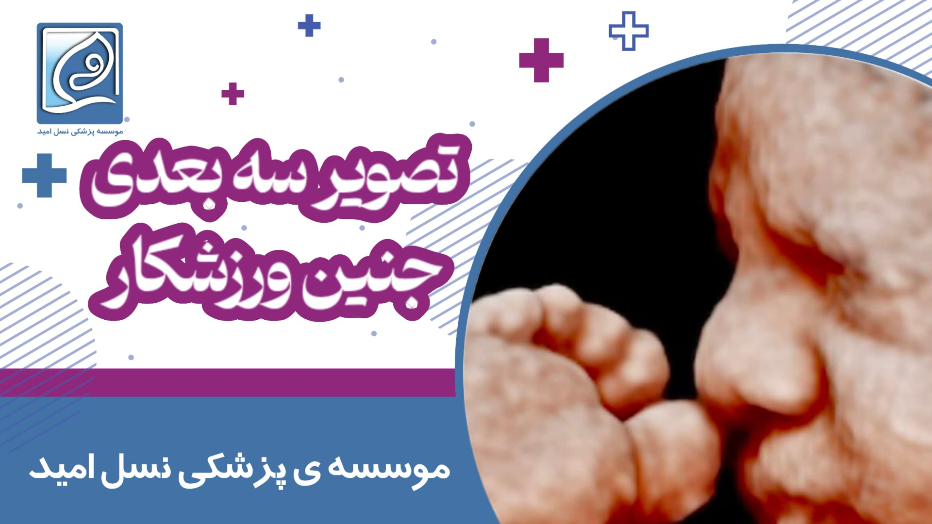 بچه تو شکم مادر ۱۸۰ زد داریوش