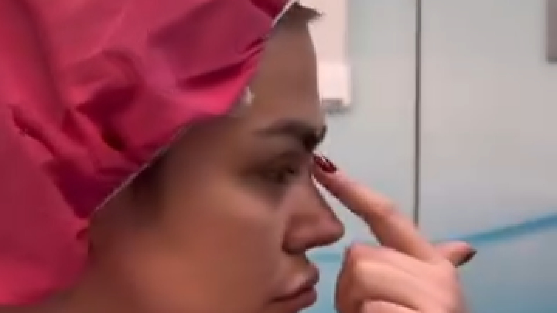 جراحی بینی ترمیمی | دکتر امین قانعی دکتر امین قانعی - جراح پلاستیک در اصفهان