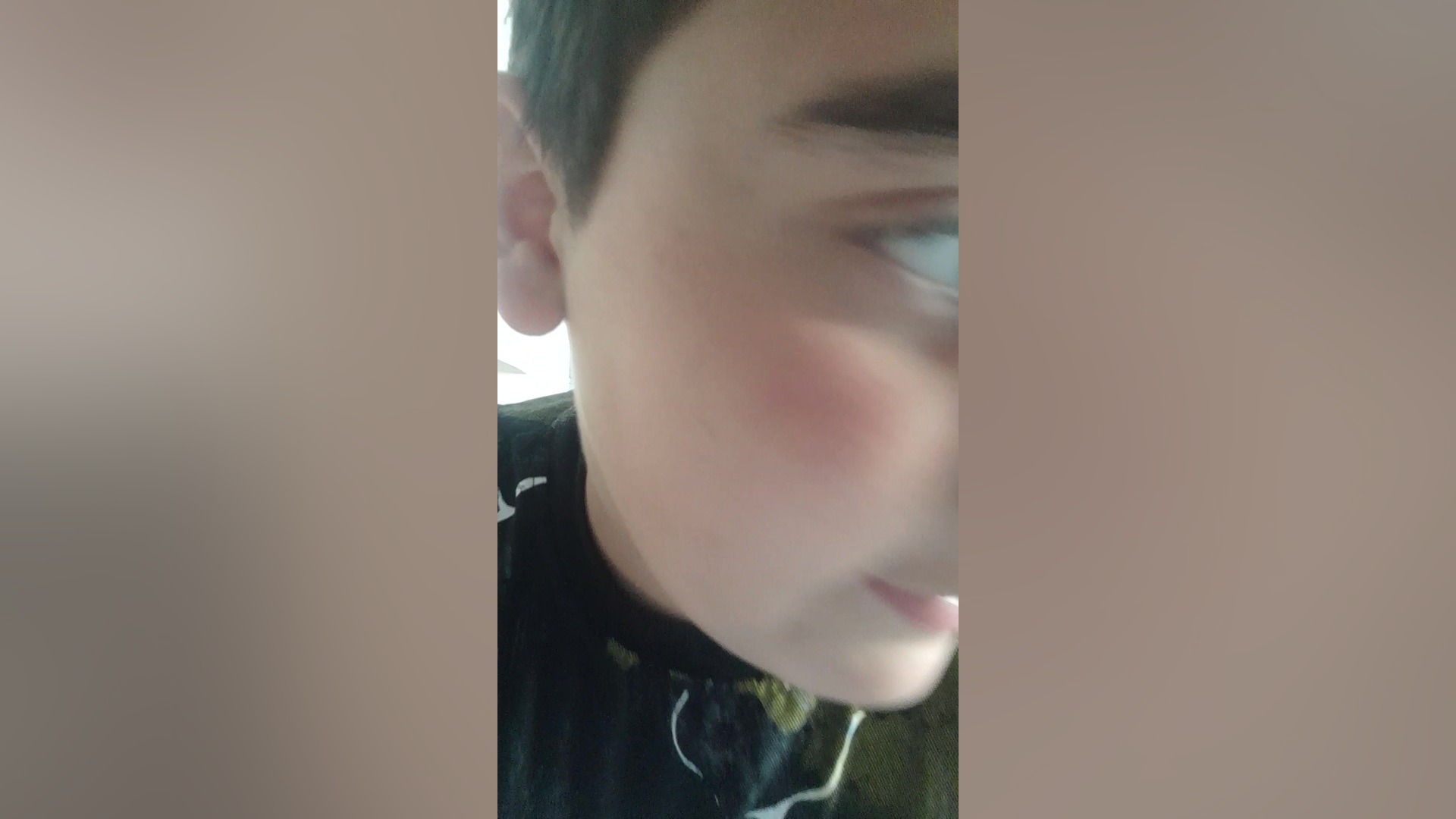 دختر شدم بلیچینگ