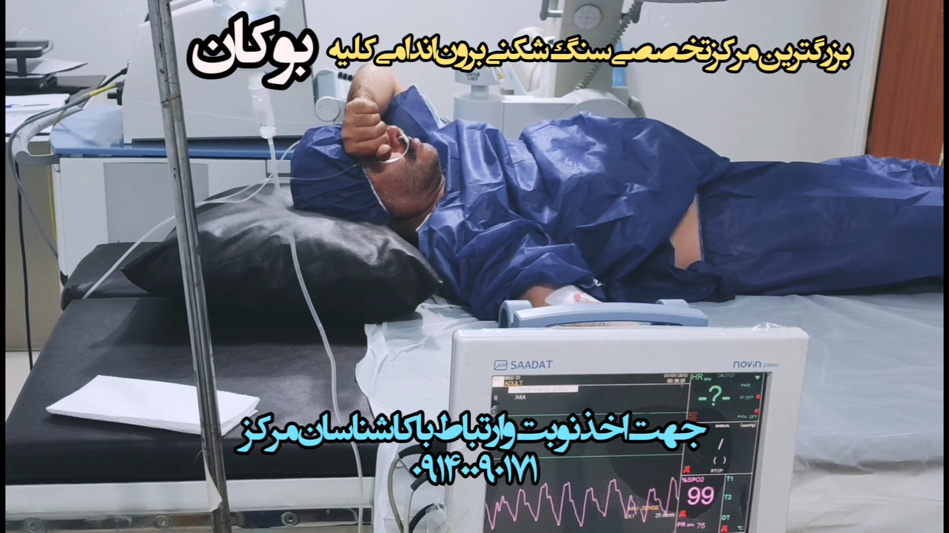 مرکز سنگ شکنی برون اندامی و لیزر سنگ کلیه در کردستان، بوکان ۰۹۱۴۰۰۹۰۱۷۱ لیفت ابرو