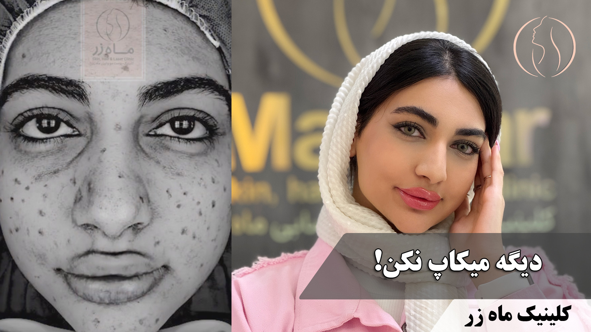 اینو بخون اگه توام نگرانی؟! ( کلینیک زیبایی ماه زر ) پلتفرم Drug Screening