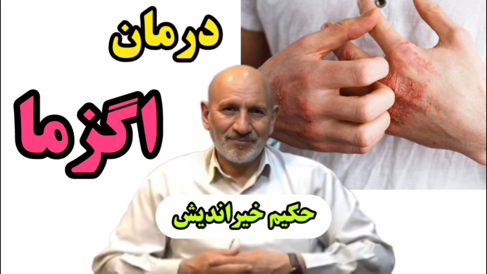راز درمان اگزما با طب سنتی از زبان حکیم خیراندیش . شماره تلفن : 09366403577 کلینیک پوست