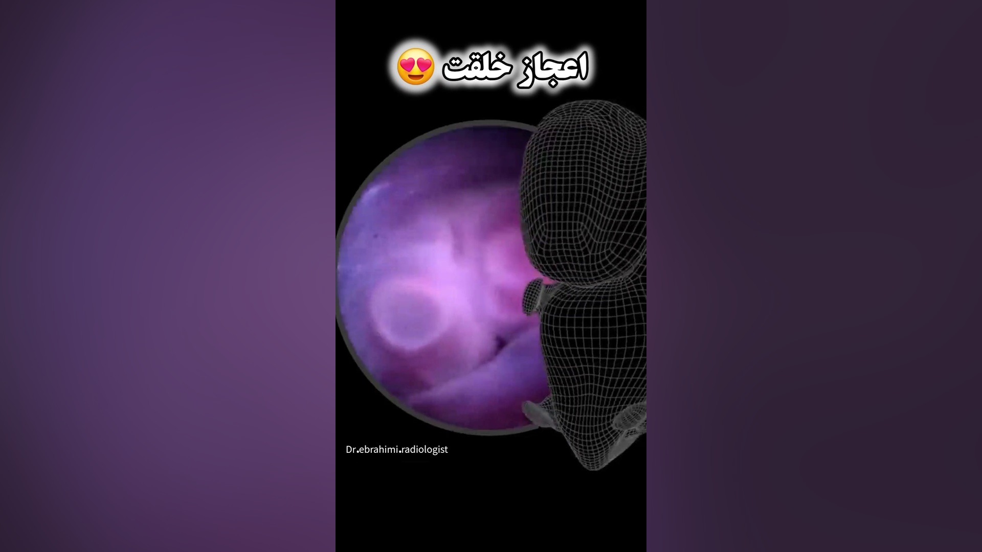 تصاویر واقعی جنین داخل رحم از ۴ تا ۸ هفتگی برای اولین بار مرکز تصویربرداری دکتر مریم ابراهیمی، مبنا-تهران