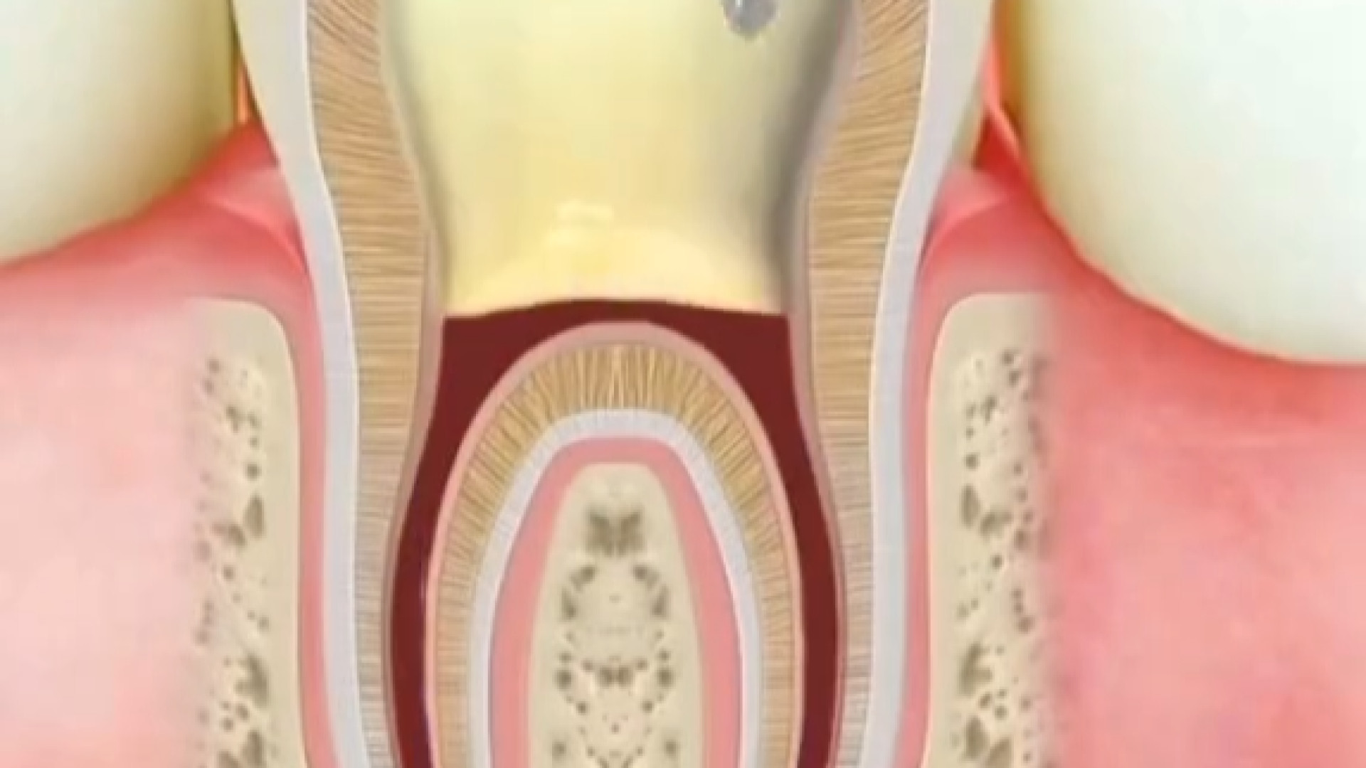 انیمیشن عصب کشی دندان Synaptic Vesicle Tracking
