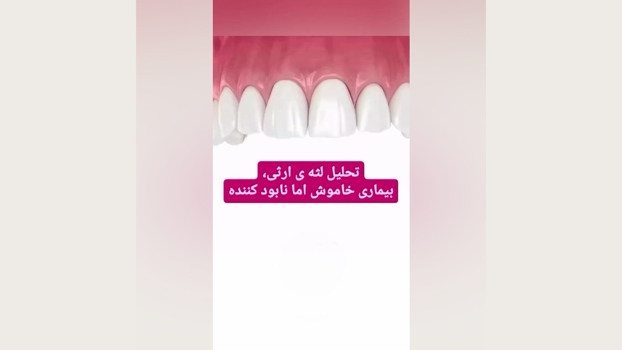 نگذار لثه هات با تحلیل لثه ی ارثی نابود بشه RNA Interference Assay
