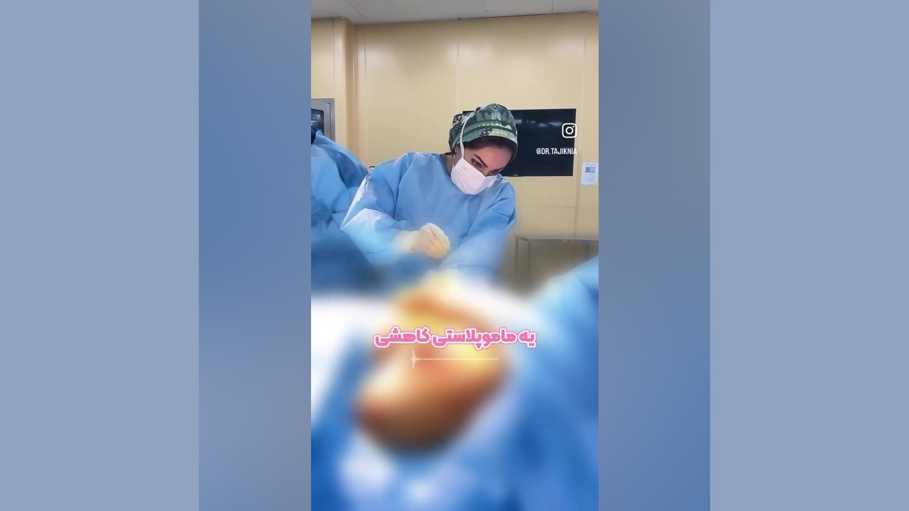 جراحی ماموپلاستی کاهشی و پیوندنوک سینه لیپوست