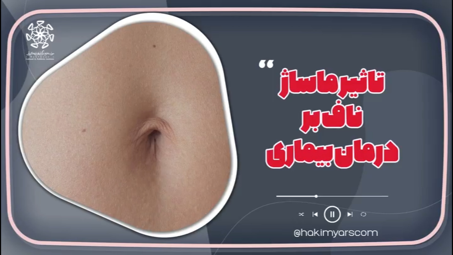تاثیر ماساژ ناف بر درمان بیماری سندرم نفروتیک ارثی