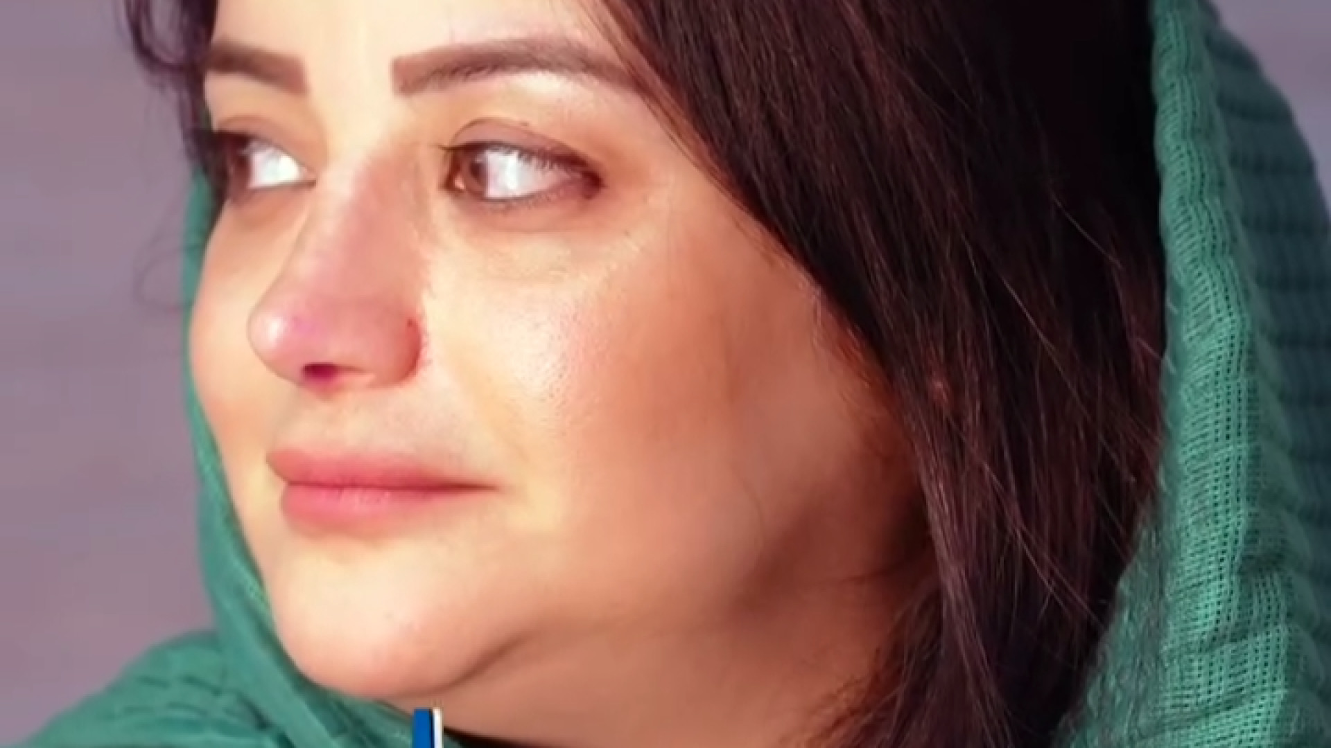 سه ماه پس از عمل رعایت صحیح و اصولیه هارمونی در صورت دکتر ابراهیم حاتمی پور