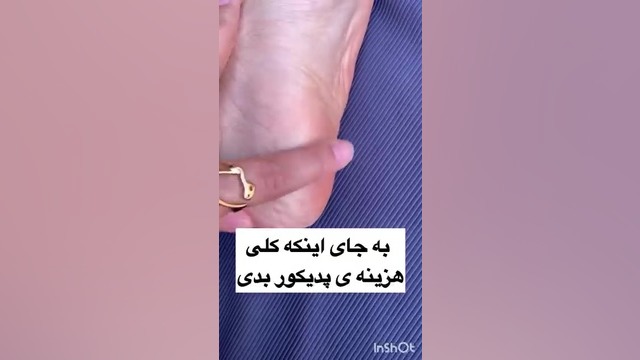 کرم ترک پا و خشکی پا وکالی اورجینال رفع چین و چروک