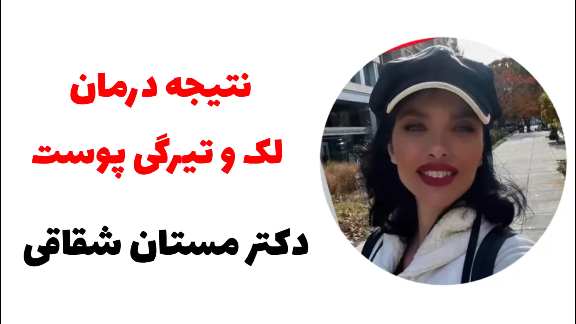 درمان لک و تیرگی پوست / دکتر مستان شقاقی لیپوساکشن