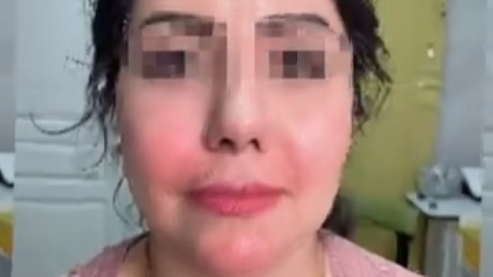 نمونه کار دکتر سارا لطفی دکتر سار ا لطفی