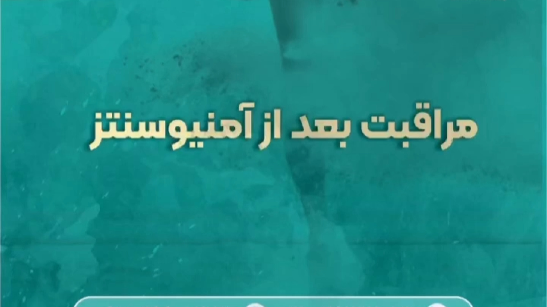 مراقبت‌های بعد از آمنیوسنتز رفع افتادگی پلک